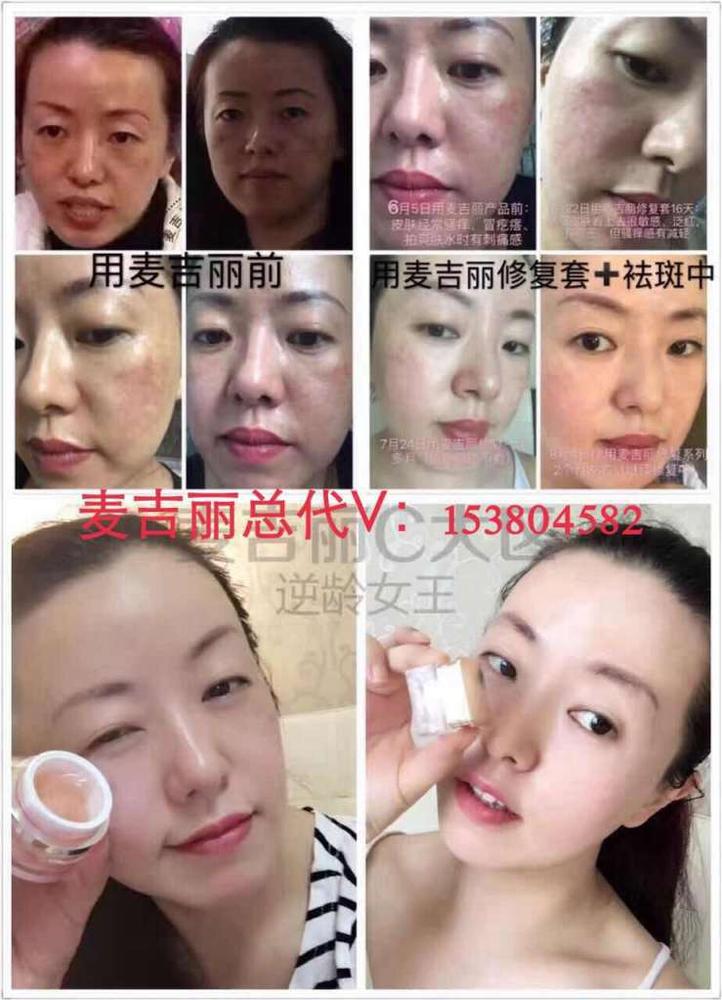 麦吉丽护肤品怎么代理? 麦吉丽素颜三部曲效果怎么样?好用吗? 麦吉丽全国总代理是谁 麦吉丽如何加盟代理? 微信:153804582 大家好,我是麦吉丽全国总代理小青,麦吉丽代理现火热招募中!! 详细咨询麦吉丽请加我微信153804582 世界上没有丑女人只有懒女人,这句在女人圈里流行的不能再流行的话如今却被一款神奇的护肤品所颠覆,那就是麦吉丽高端美容品,麦吉丽自从扬名各地之后,就一直备受追捧,不管是顶级名媛还是时尚明星,也是众多贵妇的至爱美容护肤品。 那么麦吉丽是怎么样一家公司呢?